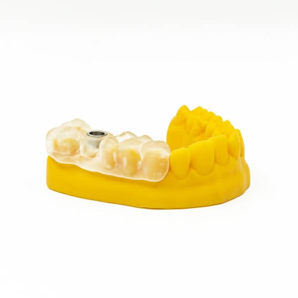 Durable Industrial Fast 6K LCD Dental 3D Printer - Image 3